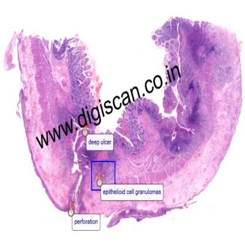 MBBS General Pathology Digital Slides Set (Microscopic Pathology)